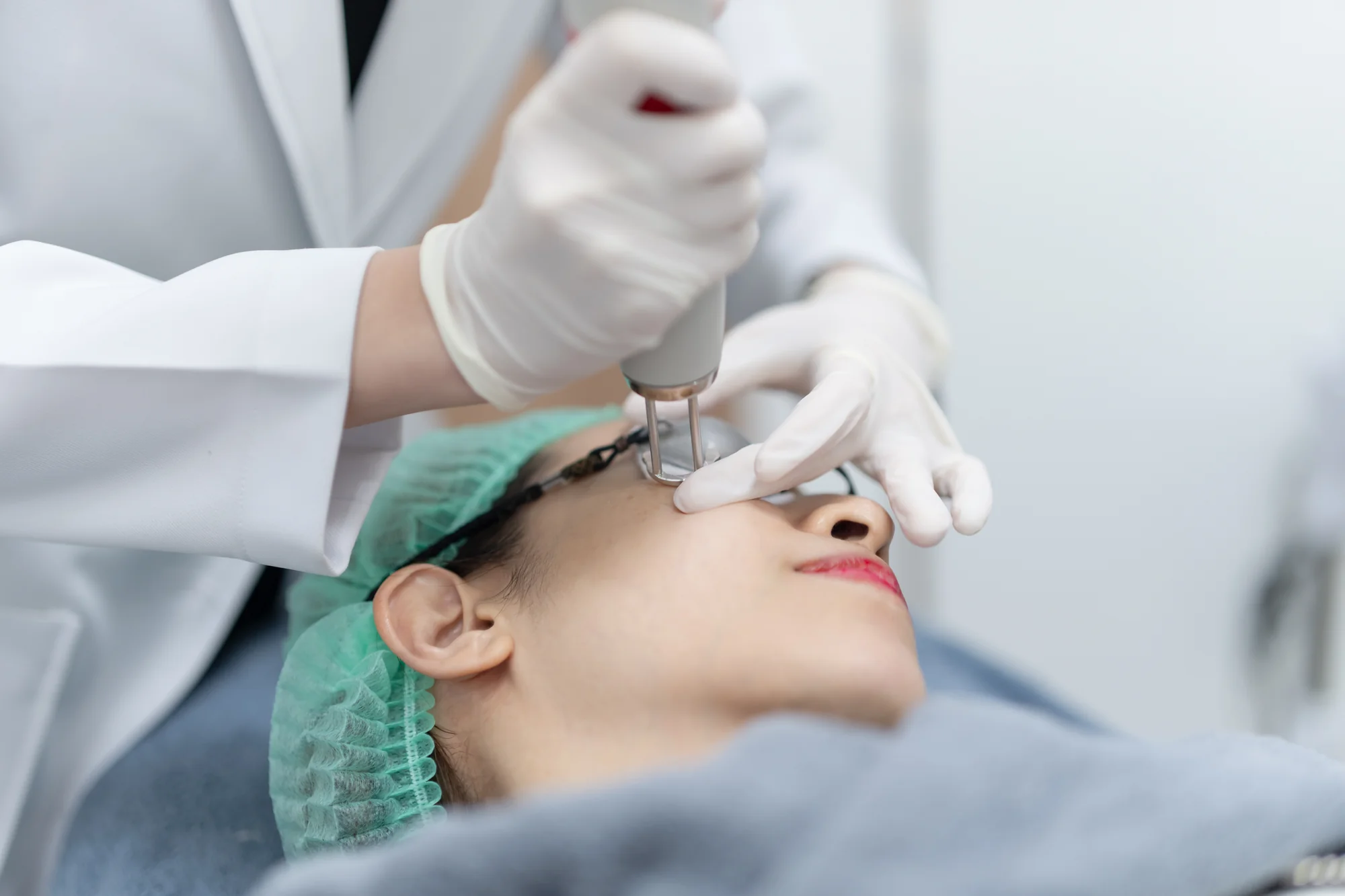 Pico Laser Treatments in Brooklyn NY