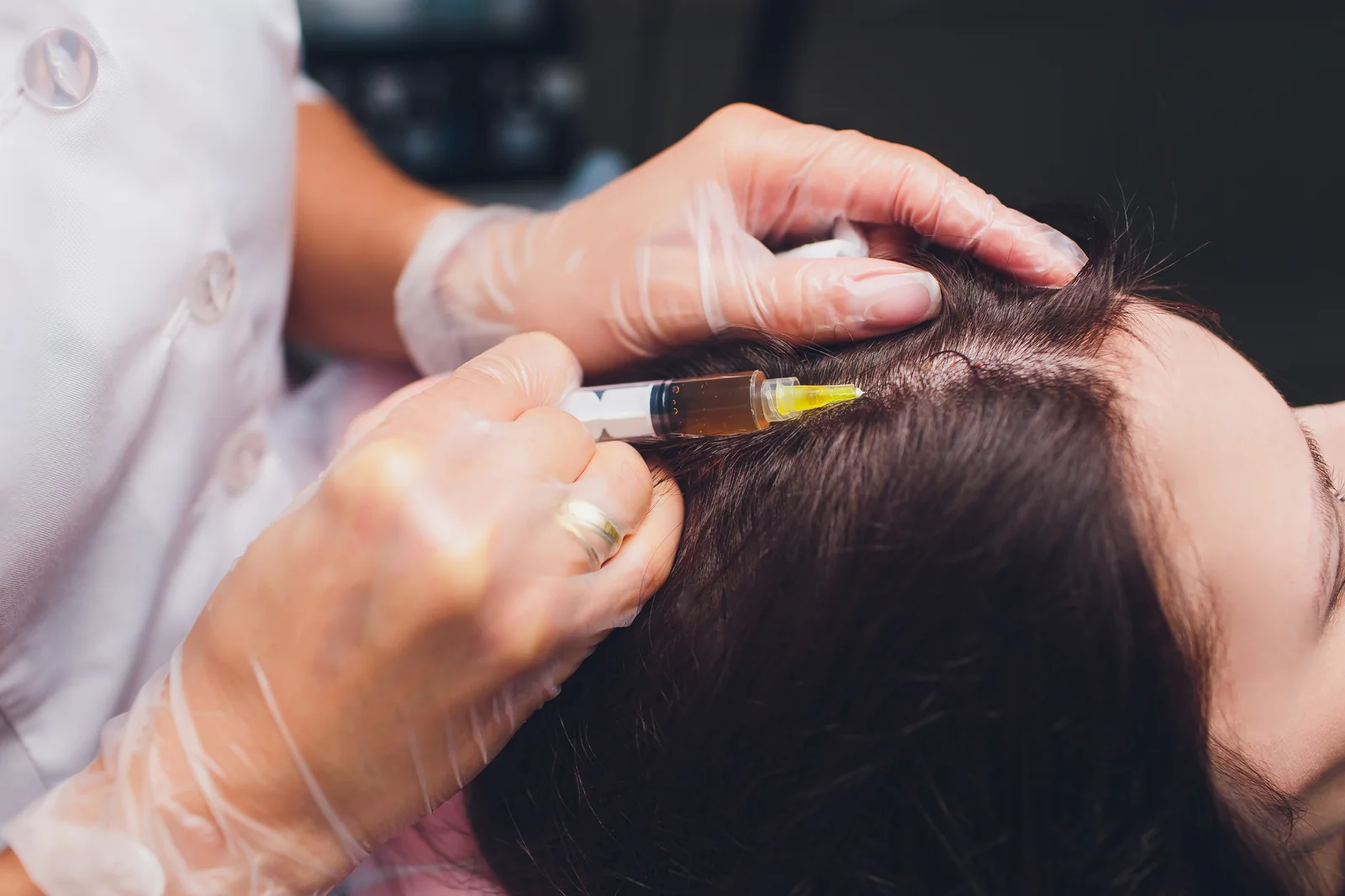 Dermatologist offers PRP treatment for hair loss