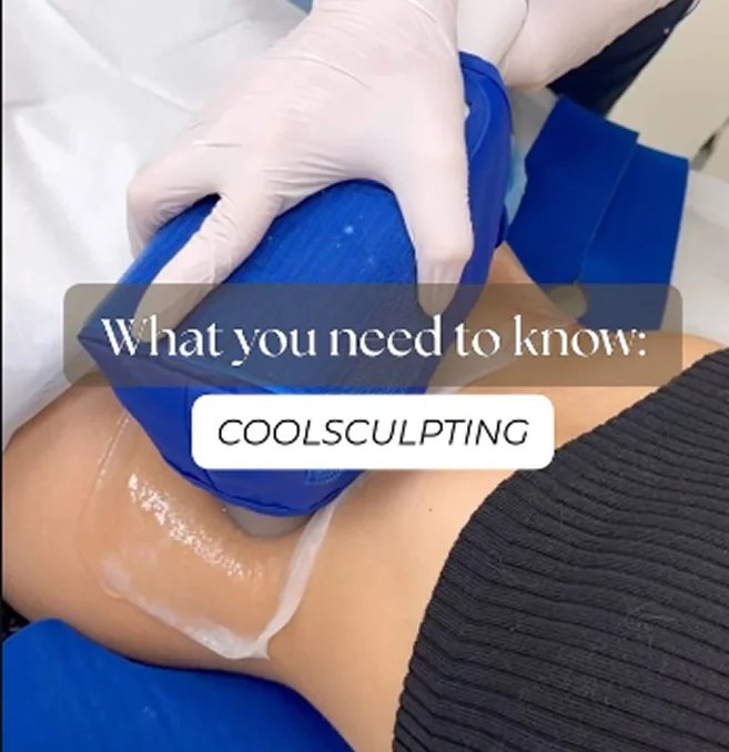 Coolsculpting