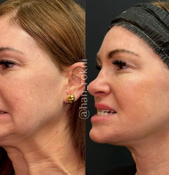 Before and After Image of Treatment