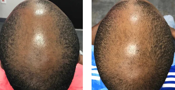 Before and After Image